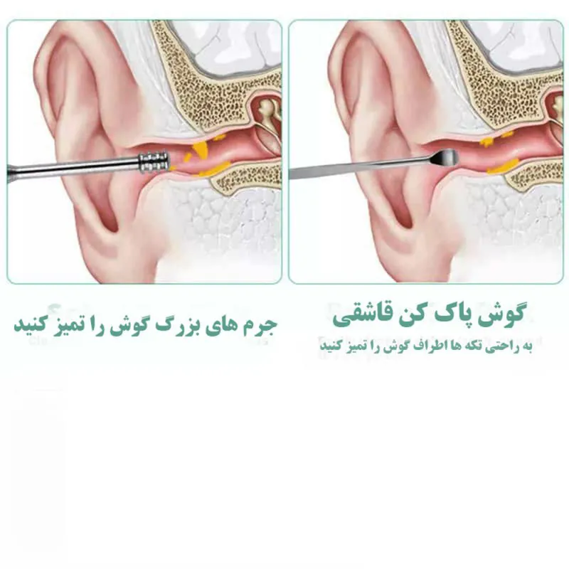 مجموعه نظافت گوش مدل M1 بسته 6 عددی - تصویر 5