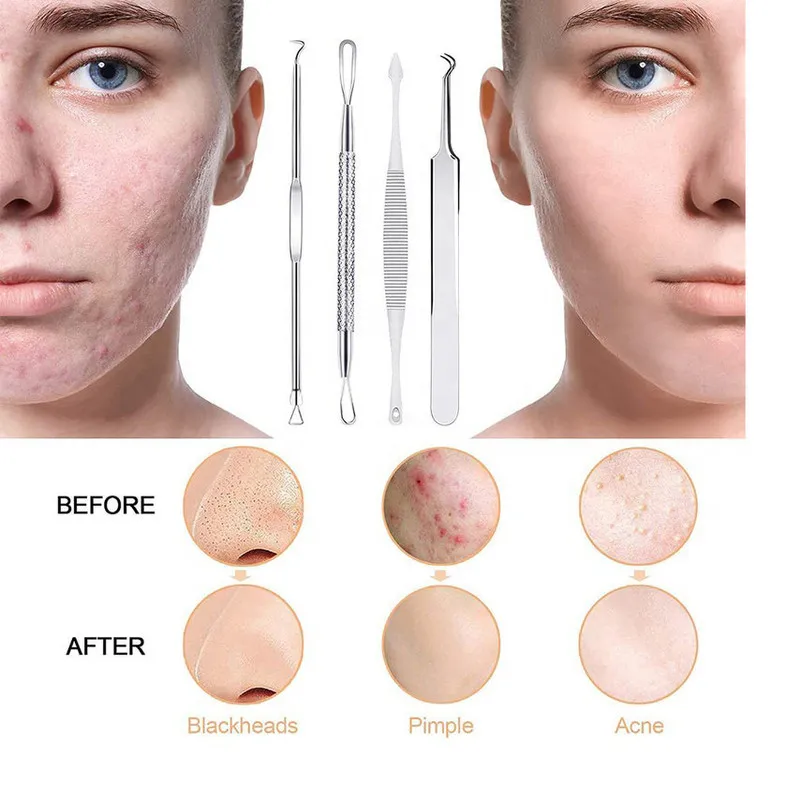 مجموعه پاک سازی پوست و کاشت مژه گرلن استایل مدل 01 بسته 10 عددی - تصویر 5