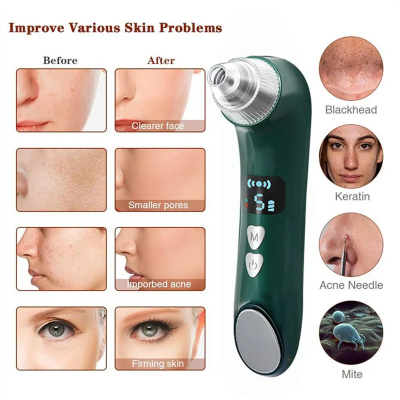 میکرودرم خانگی مدل BlackHead - تصویر 4