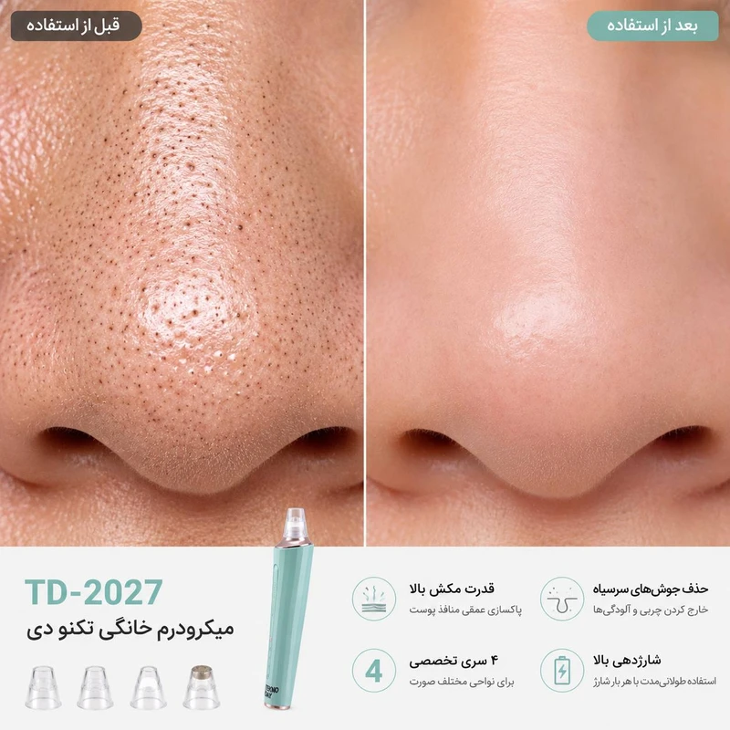 میکرودرم تکنودی مدل TD-2027 - تصویر 6