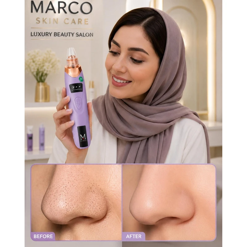 میکرودرم صورت مارکو مدل SMART-Class - تصویر 4
